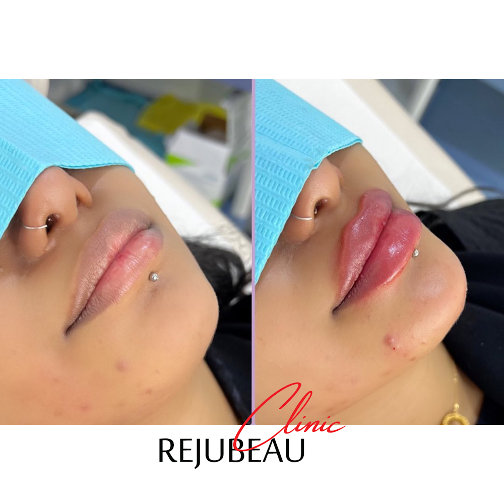 Rejubeau clinic