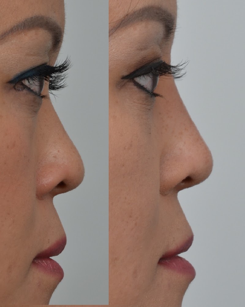 Jeffrey Jumaily Facial Plastic Surgery